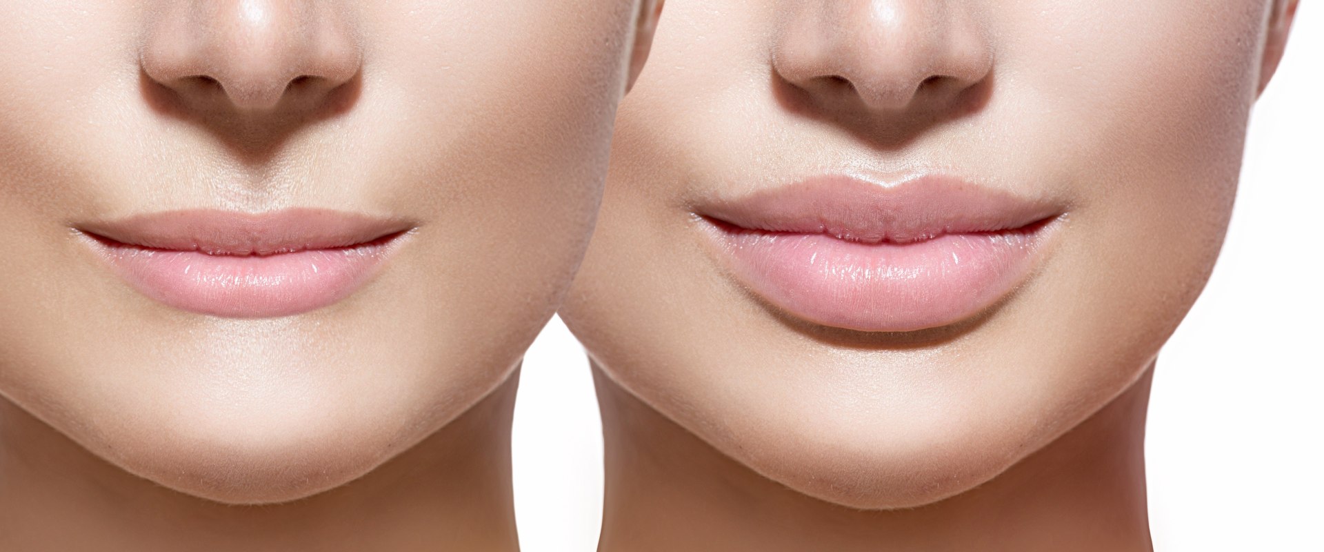 Lip injections for Fuller Lips by Curated Medical