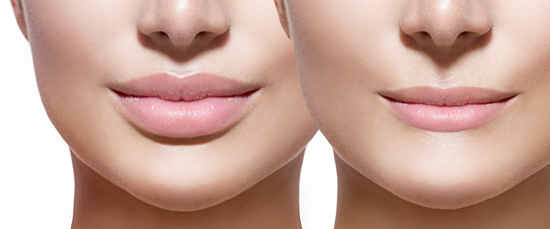 What is Permanent Lip Filler Called?