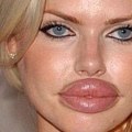 When were lip injections invented?