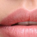 What lip injection lasts the longest?