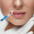 How long do needle-free lip fillers last?