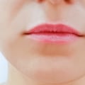 How much are lip fillers for lips?