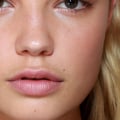 Most common lip injections?
