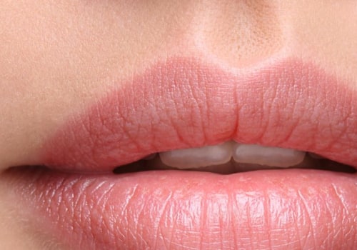 What is the Longest Lasting Lip Filler?