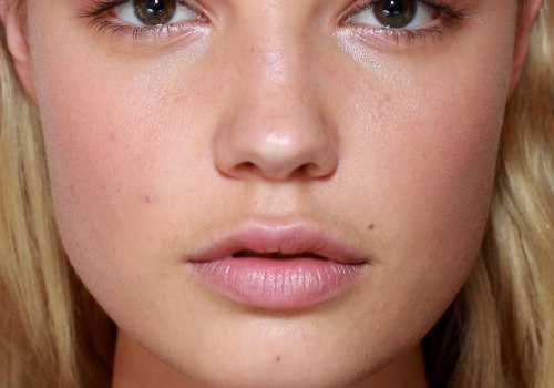 Are lip fillers bad long term?