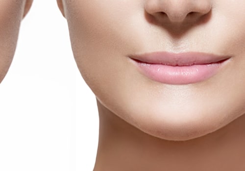 Are Lip Injections Permanent? A Comprehensive Guide
