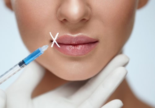 How Long Do Needle-Free Lip Fillers Last?